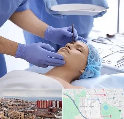 عمل بینی طبیعی در سهند تبریز