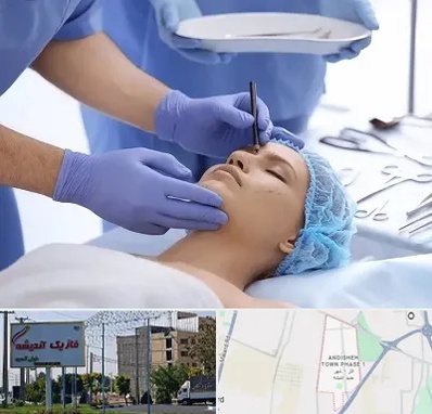 عمل بینی طبیعی در فاز یک اندیشه