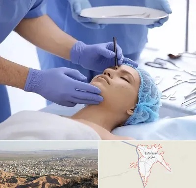 عمل بینی طبیعی در اسفراین