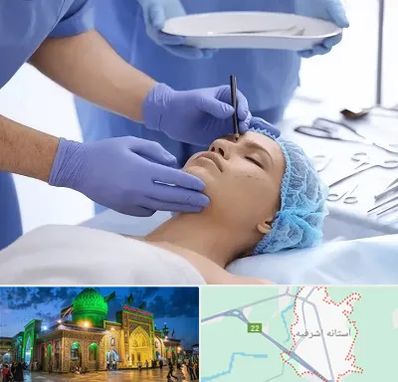 عمل بینی طبیعی در آستانه اشرفیه