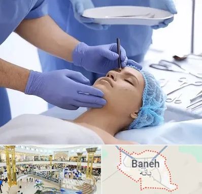 عمل بینی طبیعی در بانه