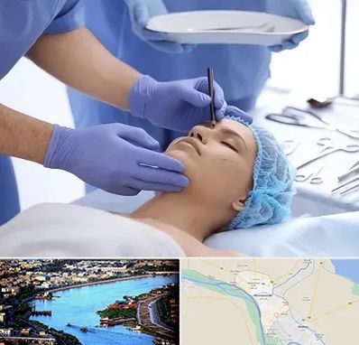 عمل بینی طبیعی در خرمشهر