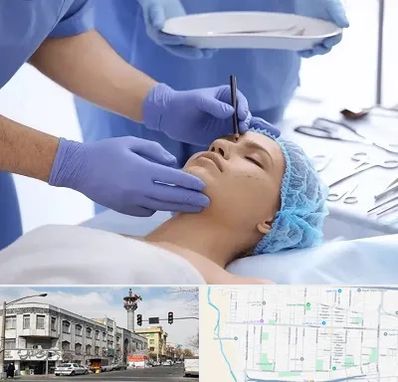 عمل بینی طبیعی در 17شهریور