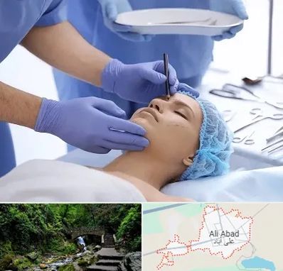 عمل بینی طبیعی در علی آباد کتول