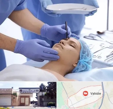 عمل بینی طبیعی در وحیدیه شهریار