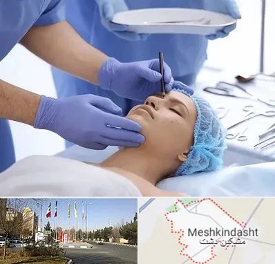 عمل بینی طبیعی در مشکین دشت