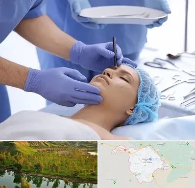 عمل بینی طبیعی در بهبهان