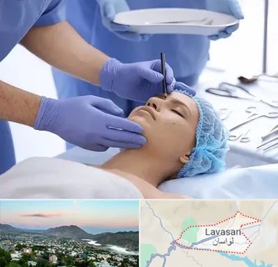 عمل بینی طبیعی در لواسان