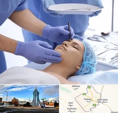 عمل بینی طبیعی در تایباد