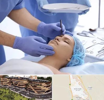 عمل بینی طبیعی در شاهین شهر