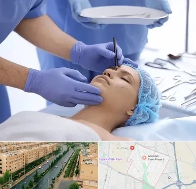 عمل بینی طبیعی در فاز سه اندیشه