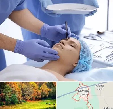 عمل بینی طبیعی در کردکوی