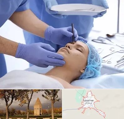 عمل بینی طبیعی در تویسرکان
