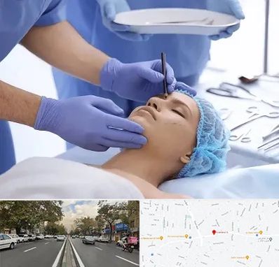 عمل بینی طبیعی در دولت