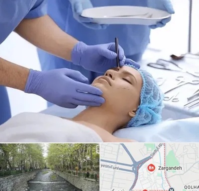 عمل بینی طبیعی در زرگنده