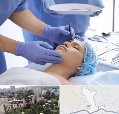 عمل بینی طبیعی در اوین