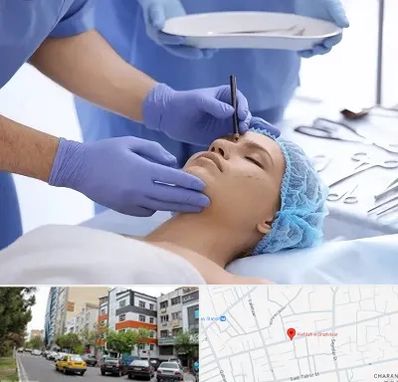 عمل بینی طبیعی در هفده شهریور تبریز