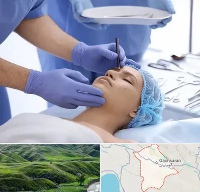 عمل بینی طبیعی در گچساران