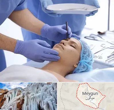 عمل بینی طبیعی در میگون