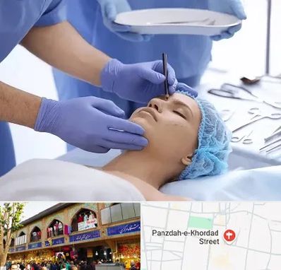 عمل بینی طبیعی در 15 خرداد