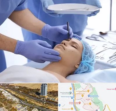 عمل بینی طبیعی در خیابان نیایش شیراز