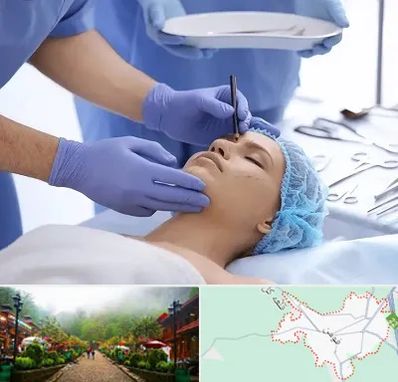 عمل بینی طبیعی در فومن