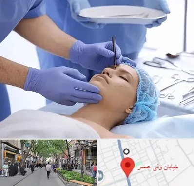 عمل بینی طبیعی در ولیعصر شهریار