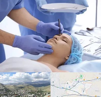 عمل بینی طبیعی در رودهن