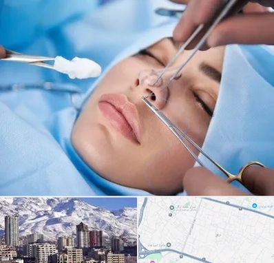 عمل ترمیمی بینی در ازگل