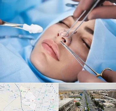 عمل ترمیمی بینی در حصارک کرج