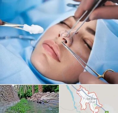 عمل ترمیمی بینی در سراوان