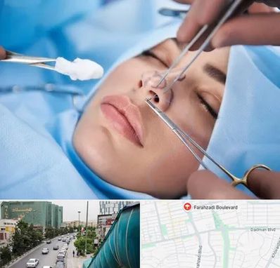 عمل ترمیمی بینی در بلوار فرحزادی