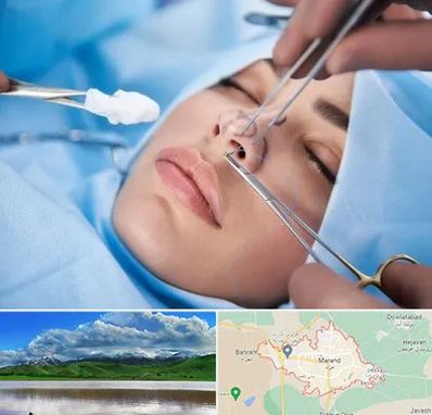 عمل ترمیمی بینی در مرند
