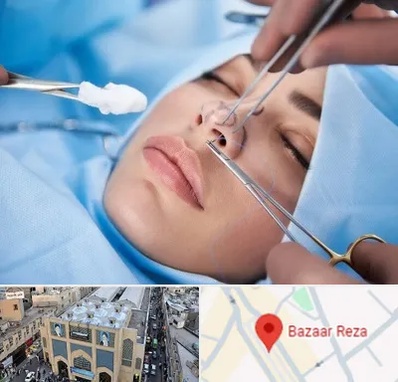 عمل ترمیمی بینی در بازار رضا مشهد