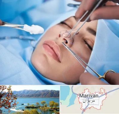 عمل ترمیمی بینی در مریوان
