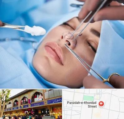 عمل ترمیمی بینی در 15 خرداد