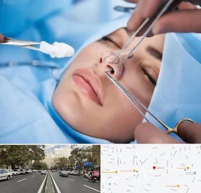 عمل ترمیمی بینی در دولت