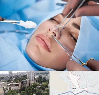 عمل ترمیمی بینی در اوین