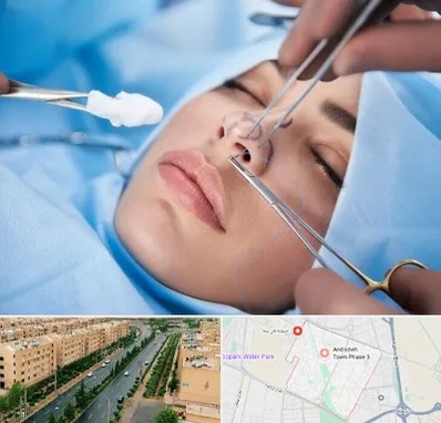 عمل ترمیمی بینی در فاز سه اندیشه