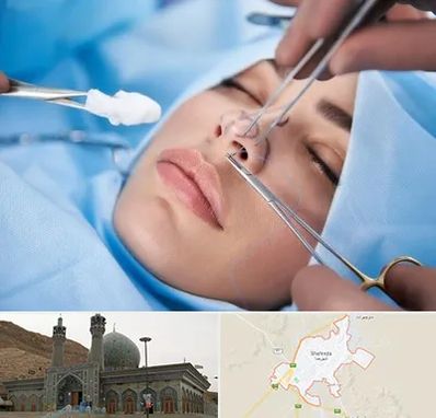 عمل ترمیمی بینی در شهرضا