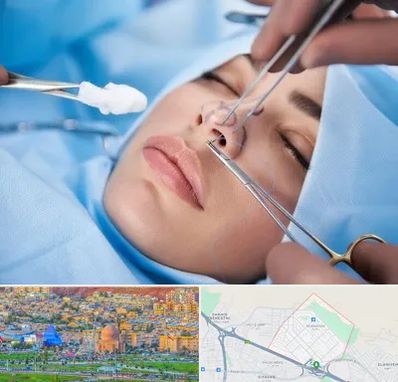 عمل ترمیمی بینی در رشدیه تبریز
