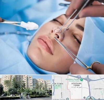 عمل ترمیمی بینی در آپادانا