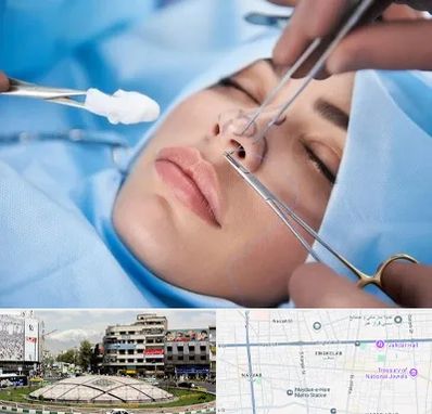 عمل ترمیمی بینی در مرکز تهران