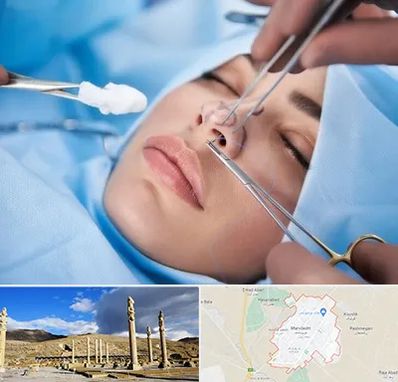 عمل ترمیمی بینی در مرودشت