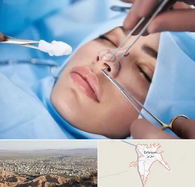 عمل ترمیمی بینی در اسفراین
