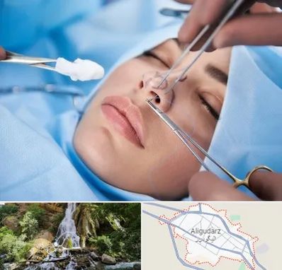 عمل ترمیمی بینی در الیگودرز