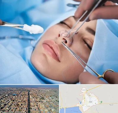 عمل ترمیمی بینی در بندر ماهشهر