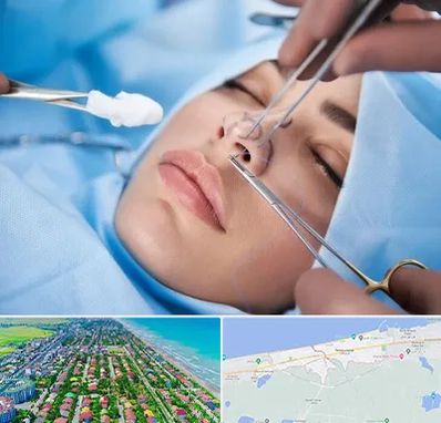 عمل ترمیمی بینی در فریدونکنار