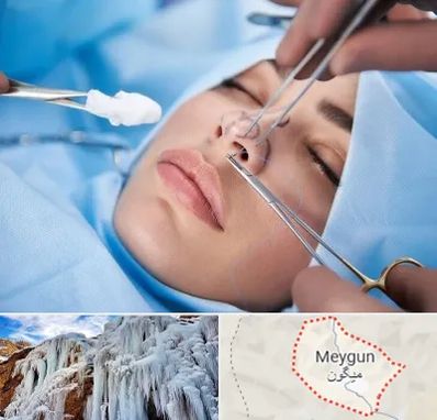 عمل ترمیمی بینی در میگون
