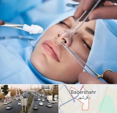 عمل ترمیمی بینی در باقرشهر